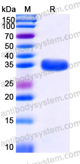 Recombinant Human &beta;-tryptase/TPSAB1 Protein, C-His (Active)
