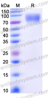 Recombinant Human CD226/DNAM-1 Protein, C-Fc (Active)