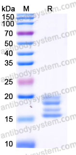Recombinant Human IL17A Protein, C-His (Active)