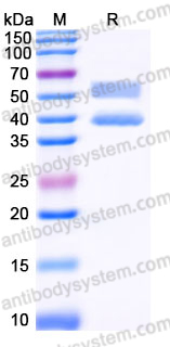 Recombinant Human CALCRL & RAMP1 Heterodimer, C-Fc & C-Fc (Active)