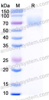 Recombinant Human TrkB /NTRK2 Protein, C-His (Active)