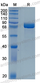 Recombinant Human MEP1A Protein, C-10*His (Active)
