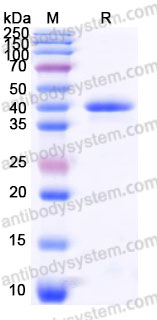 Recombinant Human RSPO1 Protein, C-His (Active)