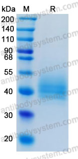 Recombinant Human GFRAL Protein, C-His (Active)