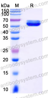 Recombinant Human TIGIT Protein, C-Fc (Active)