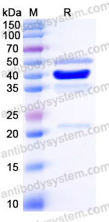 Recombinant Human TIGIT Protein, C-mFc (Active)