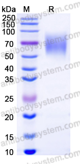 SDS-PAGE for Recombinant Human IL23R Protein, C-His (Active) ?>