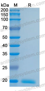 Recombinant Human IL28A/IFNL2 Protein, C-His (Active)