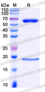 Recombinant Human PCSK9 (V474I, G670E) Protein, C-His (Active)