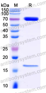 Recombinant Human PCSK9 (D374Y, V474I, G504R, G670E) Protein, C-His (Active)