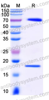 Recombinant Human PCSK9 Protein, C-His (Active)