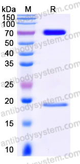 Recombinant Human PCSK9 (D374Y) Protein, C-His (Active)