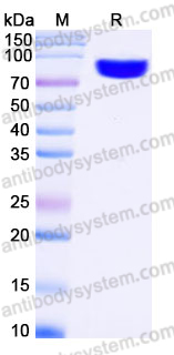 Recombinant Human LRRC15/LIB Protein, C-Fc (Active)