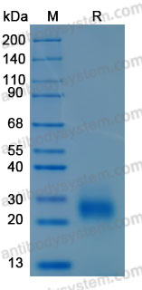Recombinant Human KLK6 Protein, C-10*His (Active)