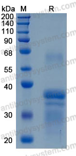 Recombinant Human RGMA Protein, C-His (Active)