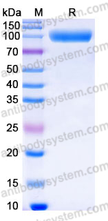 Recombinant Human CD217/IL17RA Protein, C-Fc (Active)