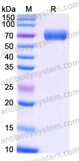 Recombinant Human CD217/IL17RA Protein, C-His (Active)