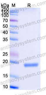 Recombinant Human IL17F Protein, C-His (Active)