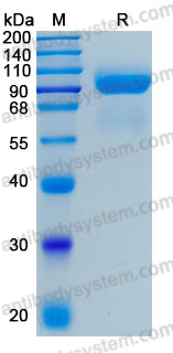Recombinant Human CD114/CSF3R Protein, C-His (Active)
