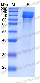 Recombinant Human OSMR/IL-31RB Protein, C-His (Active)