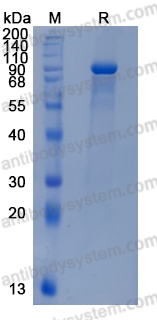 Recombinant Human SEMA3C Protein, C-hFc (Active)