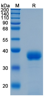 SDS-PAGE for Recombinant Human ANGPTL4 Protein, N-His (Active) ?>