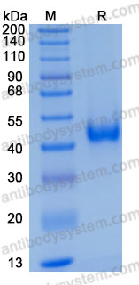 Recombinant Human CXCL16 Protein, C-His (Active)