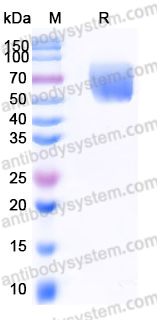 Recombinant Human CD318/CDCP1 Protein, C-His (Active)