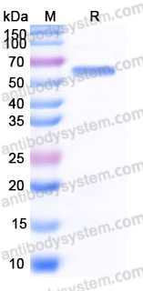 Recombinant Human IL1RL2/IL-36R Protein, C-His (Active)