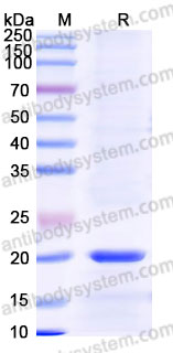 Biotinylated Human IL21 Protein, C-Avi-His (Active)