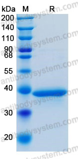 Recombinant Human CD266/TNFRSF12A Protein, C-hFc-His (Active)