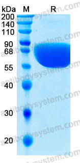 Recombinant Human CD354/TREM1 Protein, C-hFc-His (Active)
