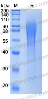 Recombinant Human ESM1 Protein, C-10*His (Active)