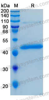 Recombinant Human PDGFC Protein, N-His-hFc (Active)
