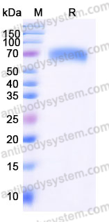Recombinant Human IL17RB Protein, C-Fc (Active)