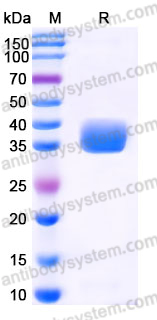 Recombinant Human CD274/PD-L1/B7-H1 Protein, C-His (Active)
