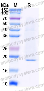 Recombinant Human IL17C Protein, C-His (Active)