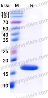 Recombinant Human IL36RN/IL-1F5/IL-36Ra Protein, Tag free (Active)
