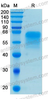 Recombinant Human CD264/TNFRSF10D/TRAIL-R4 Protein, C-hFc-His (Active)