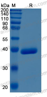 Recombinant Human CTSZ Protein, C-10*His (Active)