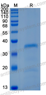 Recombinant Human DKK4 Protein, C-10*His (Active)