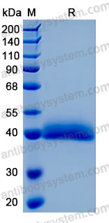 Recombinant Human KLK11 Protein, C-10*His (Active)