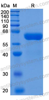 Recombinant Human DPP7 Protein, C-10*His (Active)