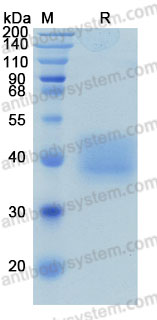 Recombinant Human CD84 Protein, C-His (Active)