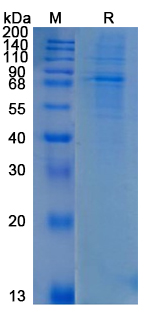 Recombinant Human ADAM28 Protein, C-His (Active)