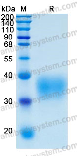Recombinant Human CD201/PROCR/EPCR Protein, C-His (Active)