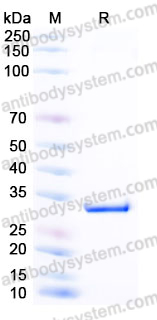Recombinant Human CA5B Protein, C-His (Active)