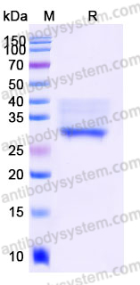 Recombinant Human ANGPTL3 Protein, C-His (Active)