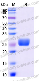 Recombinant Human CD265/TNFRSF11A Protein, C-His (Active)