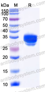 Recombinant Human IgE/IGHE Protein, C-His (Active)